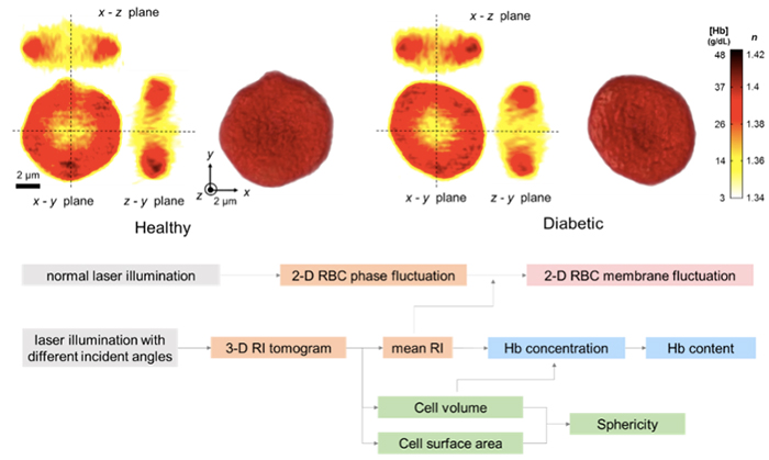 Figure 1 Three cross-sectional slices of 3-D refractive index tomograms and rendered isosurfaces of the representative healthy and diabetic red cells (top). A flow chart for retrieving six red cell indices (bottom).