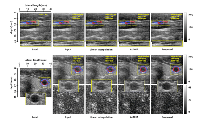 Figure 1. B-mode ultrasound image reconstruction results from Carotid region using linear array probe. 