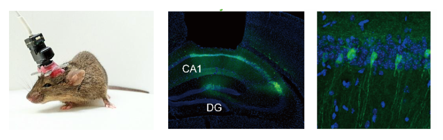 Scheme 1. Miniaturized microscope imaging of neuronal activity in freely behaving mice 