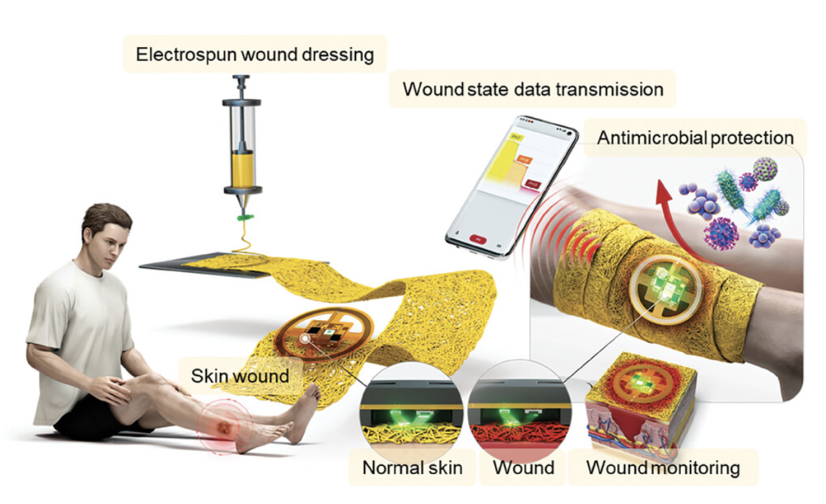 Scheme 1. Colorimetric wound dressing and optoelectronic sensor-based advanced wound care syste